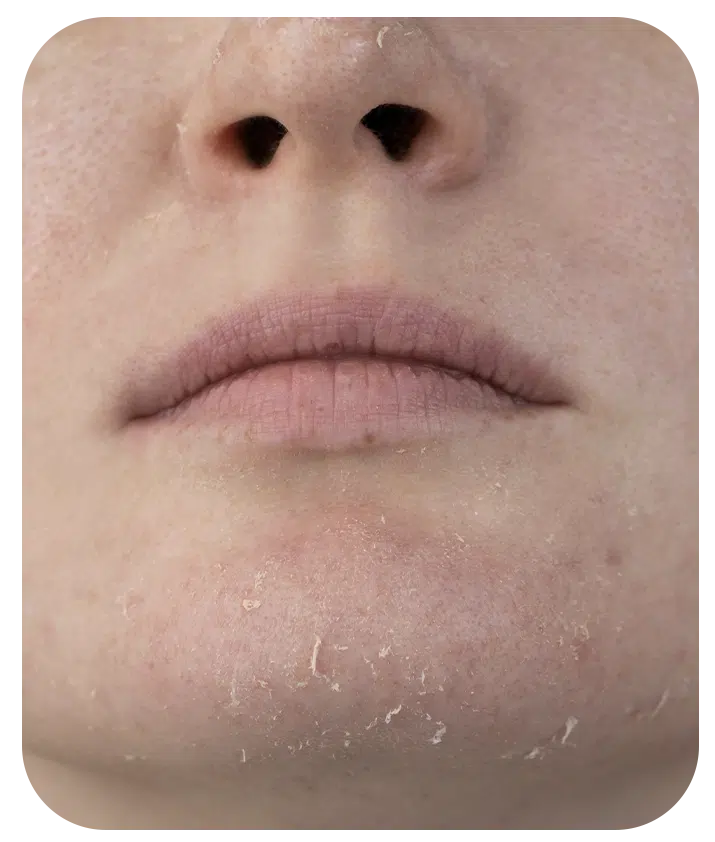 2% Hyaluronic Acid Gel - 1.7 fl oz