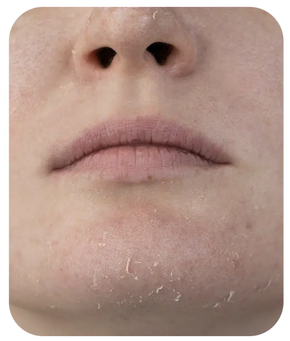 2% Hyaluronic Acid Gel - 1.7 fl oz
