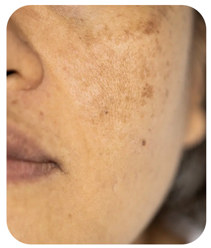 Retinol + Bakuchiol Serum 1%  - 1 fl oz