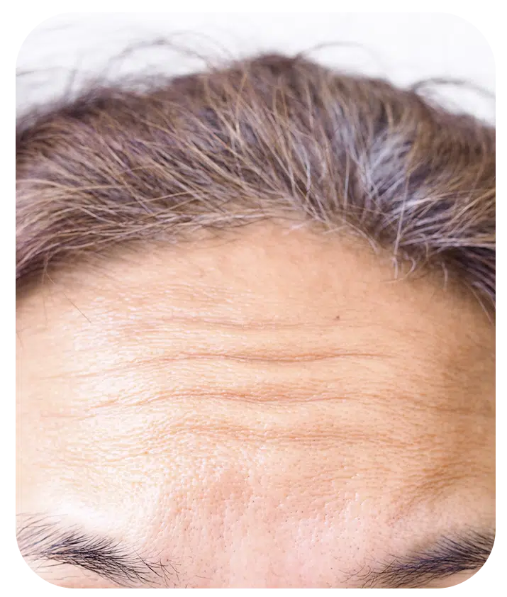 Retinol + Bakuchiol Serum 1%  - 1 fl oz