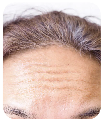 Retinol + Bakuchiol Serum 1%  - 1 fl oz