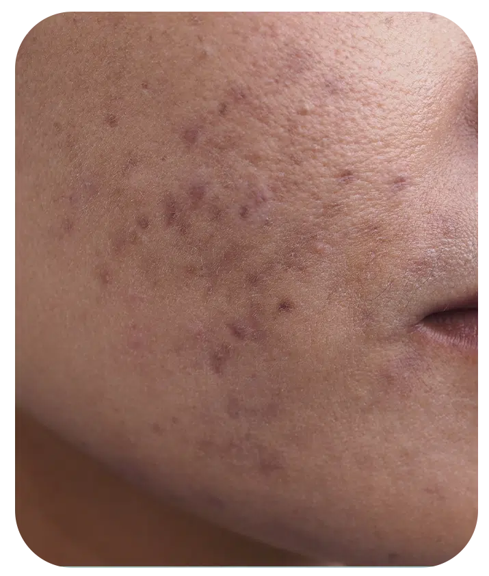 Retinol + Bakuchiol Serum 1%  - 1 fl oz