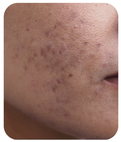 Retinol + Bakuchiol Serum 1%  - 1 fl oz
