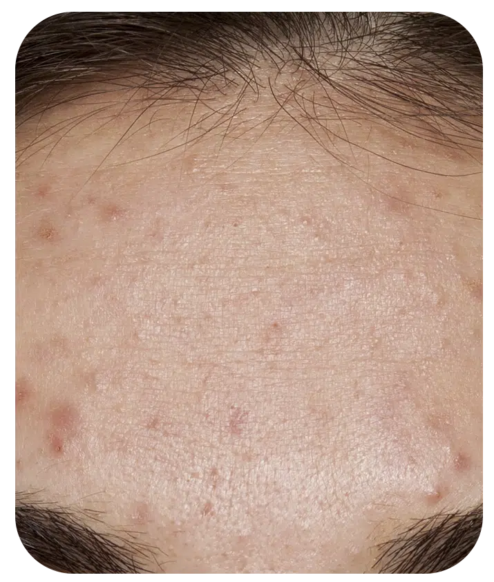 Retinol + Bakuchiol Serum 1%  - 1 fl oz