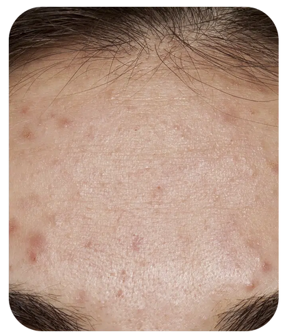 Retinol + Bakuchiol Serum 1%  - 1 fl oz