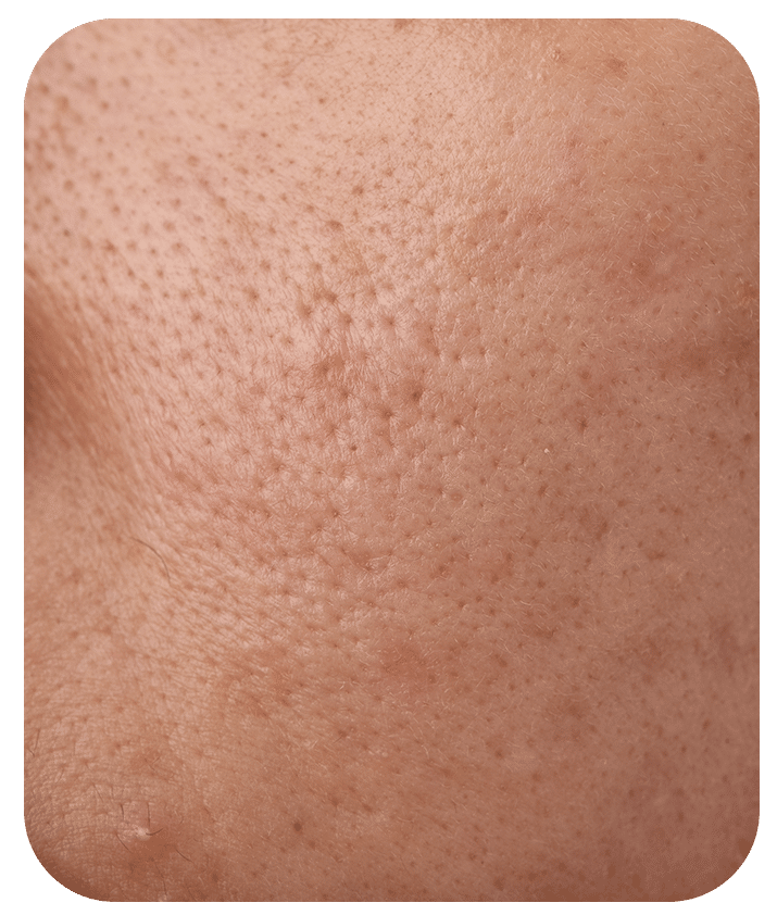 Light Foaming Cleanser - 8 fl oz