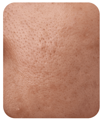 Light Foaming Cleanser - 8 fl oz
