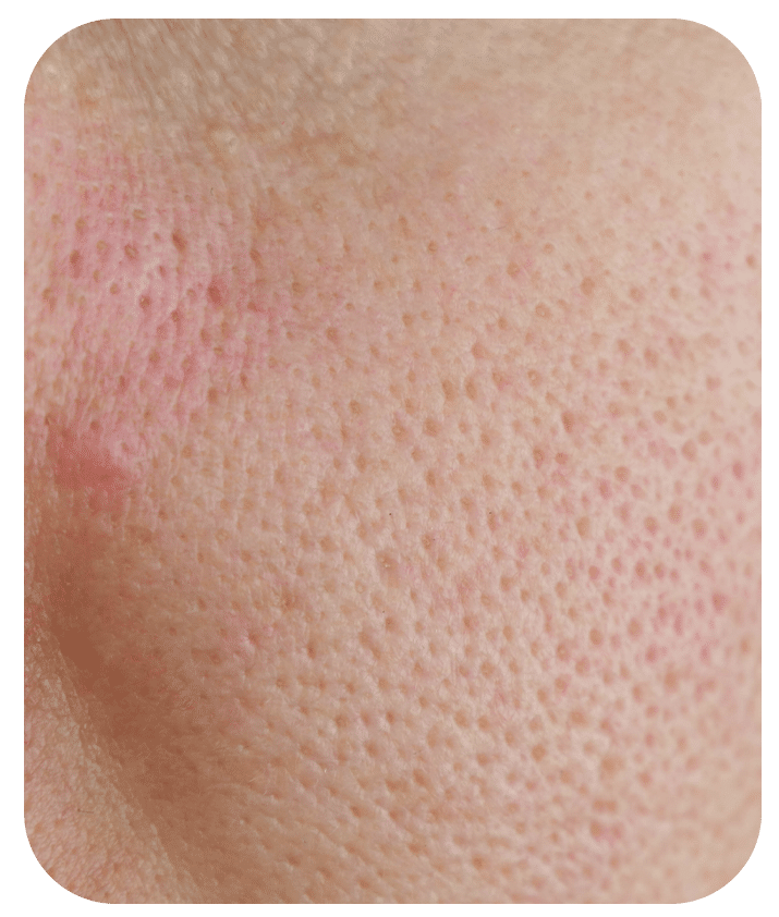 Light Foaming Cleanser - 8 fl oz