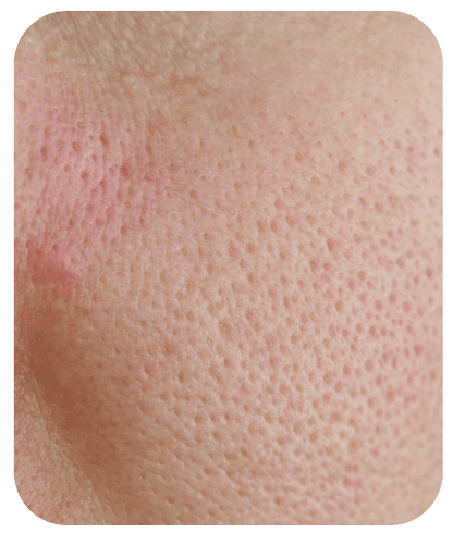Light Foaming Cleanser - 8 fl oz